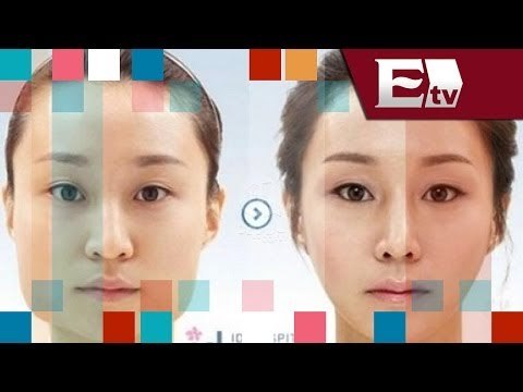 Cirugías plásticas que te dejan irreconocible/ Entre Mujeres