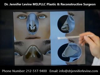 Dr. Jennifer Levine, Best Nose Surgeon in New York explains the Nasal Anatomy