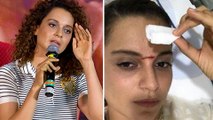 Kangana Ranaut REACTS On INJURY While Simran Shooting | Behind The Scenes