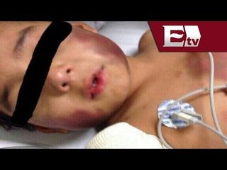 Niño de 5 años es brutalmente golpeado por el novio de su mamá / #RescatemosAOwen
