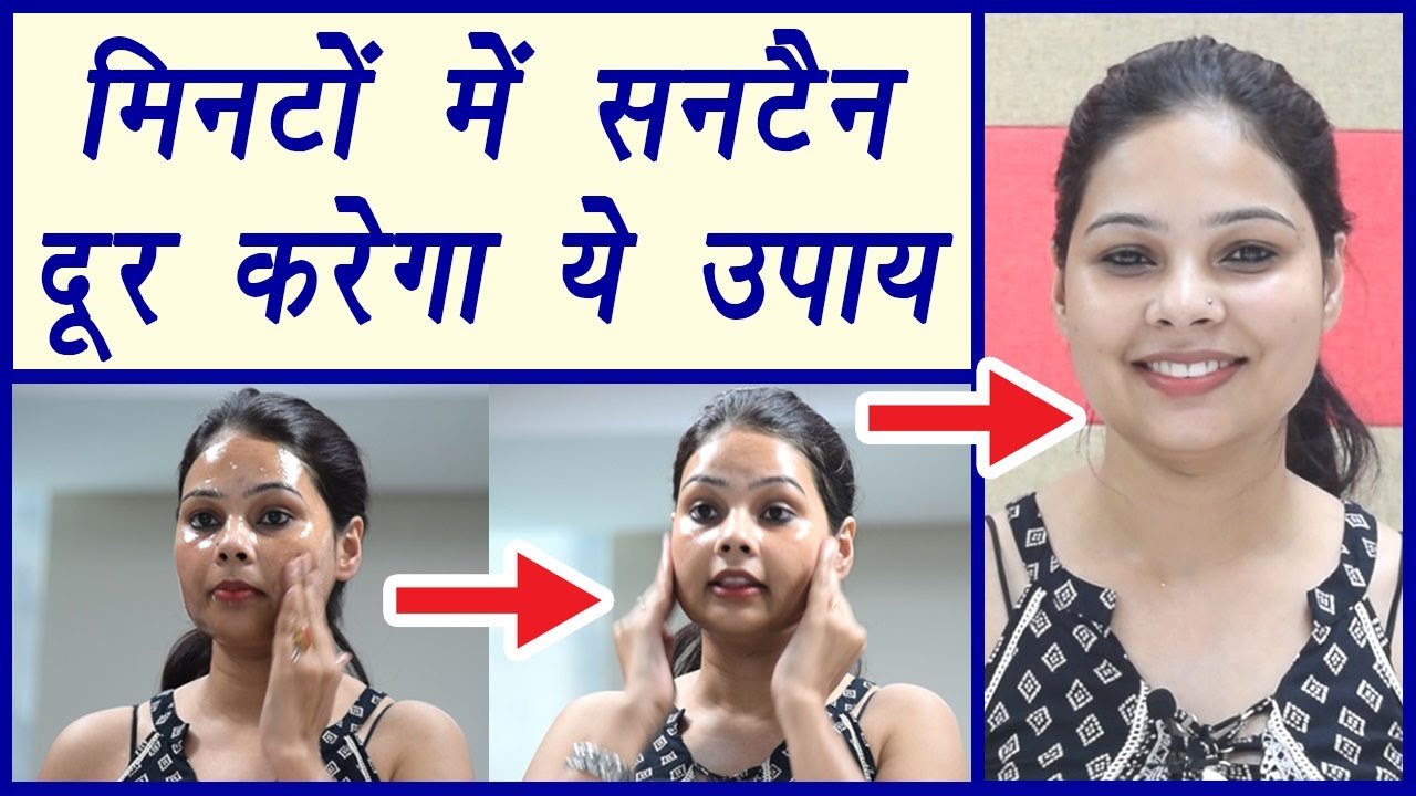 Sun Tan removal Aloevera pack | DIY | मिनटों में सनटैन दूर करेगा ये घरेलू उपाय | BoldSky