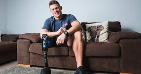 One-Legged Model Becomes Catwalk Star