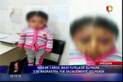 Arequipa: médico indicó que niña habría sido golpeada por sus familiares