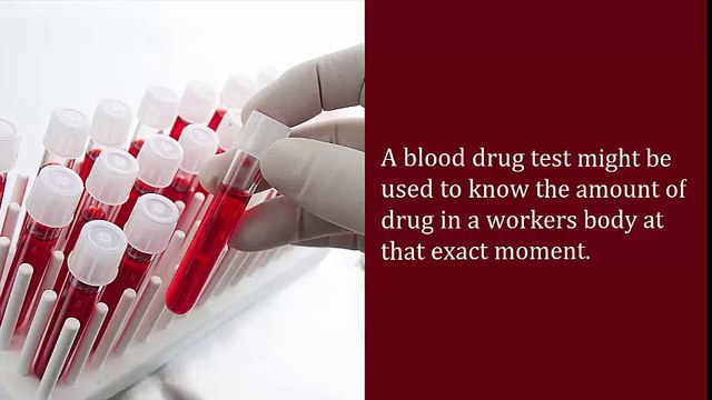 Kinds of Drug Test for Workplace Drug Testing
