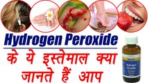 Hydrogen Peroxide: Beneficial Uses at home, ऐसे करें घर में हाइड्रोजन पेरोक्साइड का इस्तेमाल | Boldsky