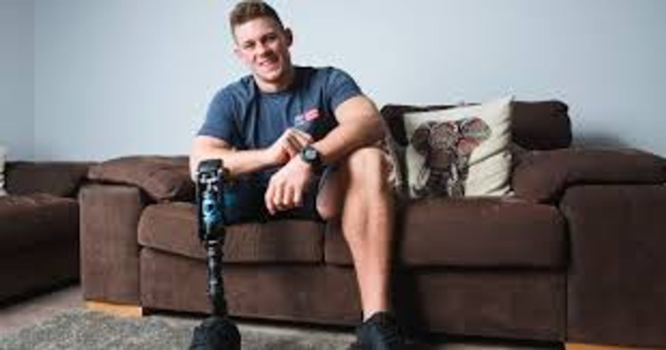 One-Legged Model Becomes Catwalk Star