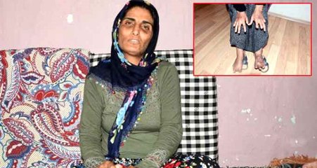 Eşi Tarafından 11 Parmağı Kesilen Gülfidan Konuştu: O Cani Bir An Önce Cezasını Bulsun