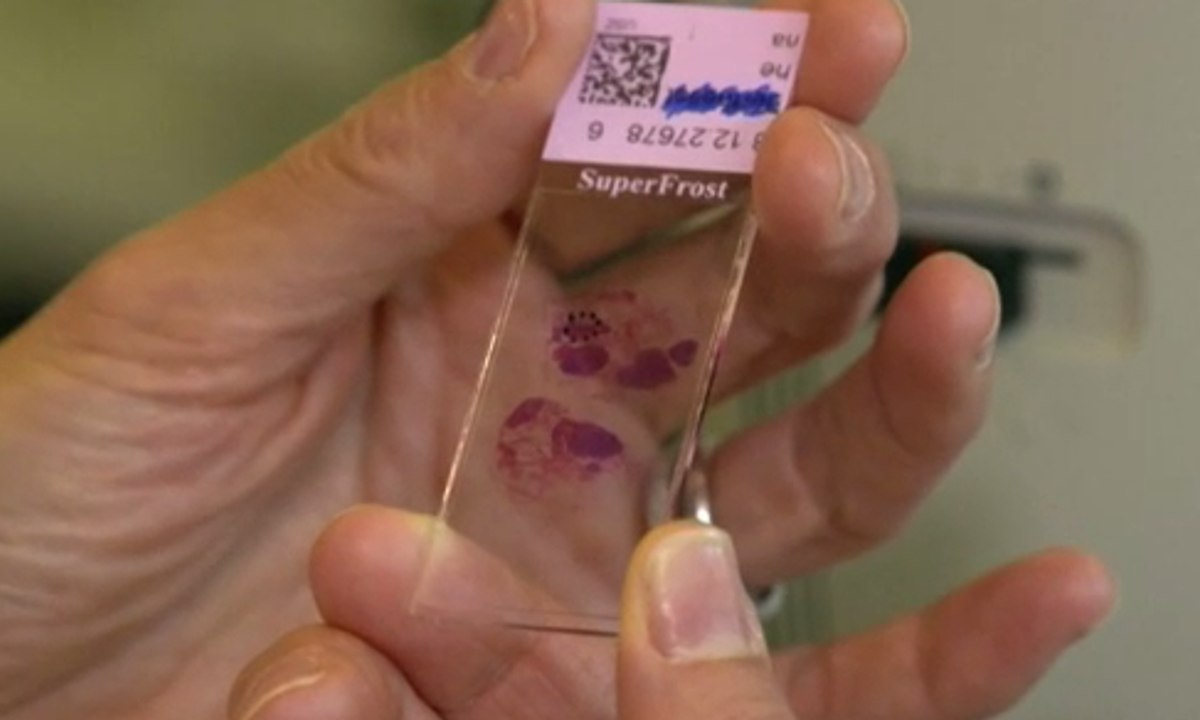 Robot dengan Kecerdasan Buatan Hasilkan Obat Baru