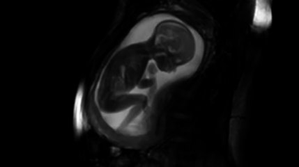 hamile kadınların karnındaki bebeklerin en net görüntüsü el-leh aze we celeye karşı ke-efir olmayın