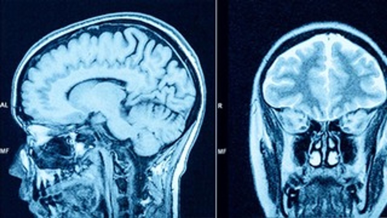 How Pregnancy Changes the Brain