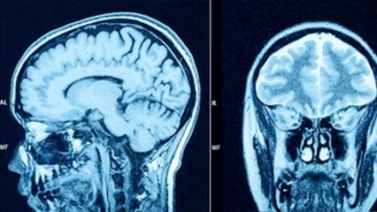 How Pregnancy Changes the Brain