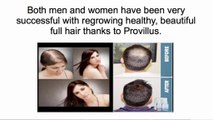 How to Regrow Hair Fast - Best Hair Loss Natural Balding Treatment!