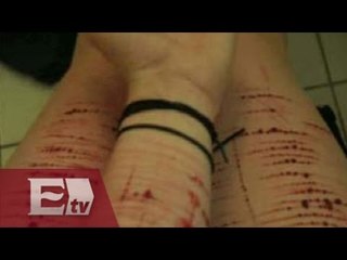 Alerta por práctica de 'cutting' entre adolescentes de Zacatecas / Vianey Esquinca