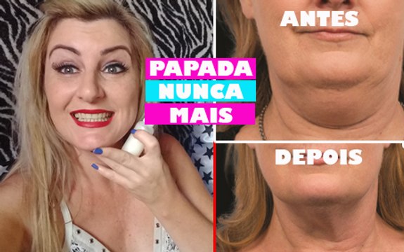 Como acabar COM A PAPADA flacidez e RUGAS no PESCOÇO em 2 MINUTOS