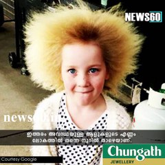 Melbourne schoolgirl Unbrushable Hair Syndrome