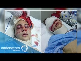 Nieta de Cantinflas recibe tremenda golpiza en caso de violencia familiar