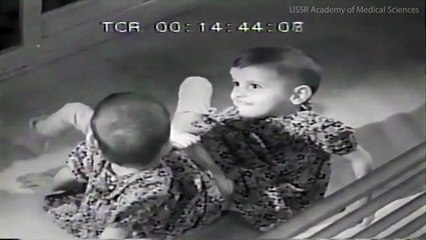 Chấn động lịch sử ngành y: Bí mật cặp song sinh dính liền bị bắt cóc để thực hiện những thí nghiệm tàn độc