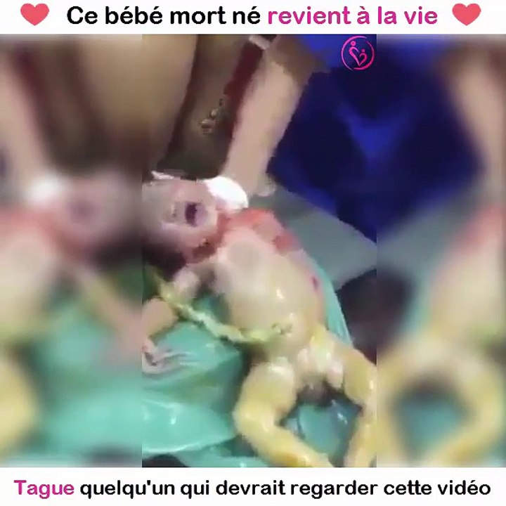 ce bébé mort né revient à la vie
