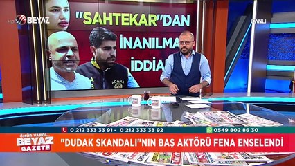 ''Dudak Skandalı''nın baş aktörü fena enselendi!