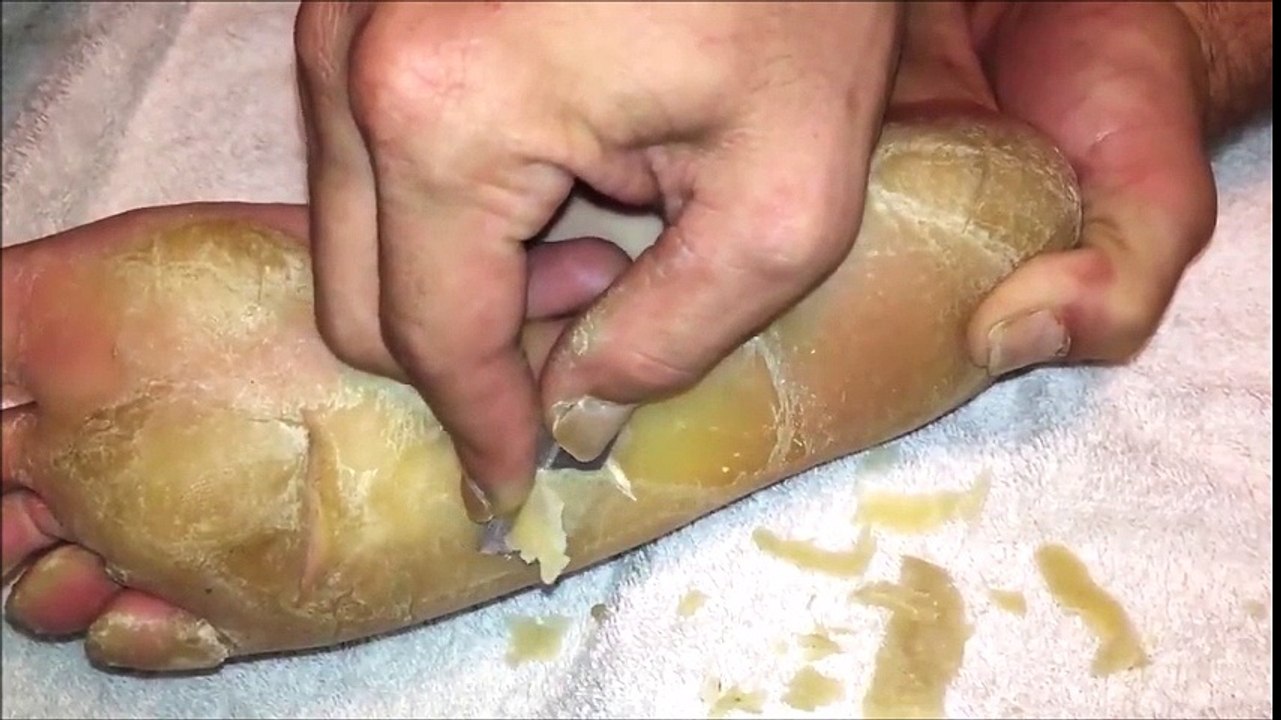 この足やばくない？