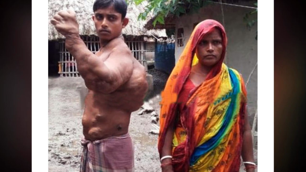 মুক্তামনির পরে মারাত্বক রোগে আক্রান্তু সাতক্ষীরার রাজীব !! দেখুন আল্লাহ্ আপনাকে কত শান্তিতে রেখেছেন!