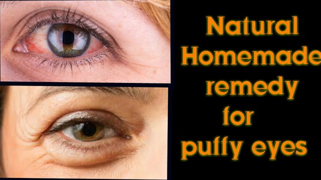 How to get rid puffy eyes ,swollen eyelids & dark