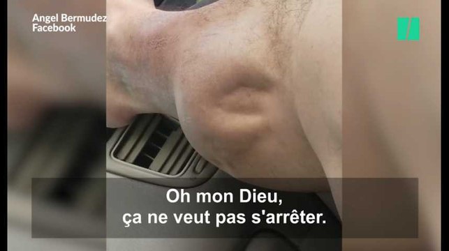 Une crampe de l'extrême, ça ressemble à ça