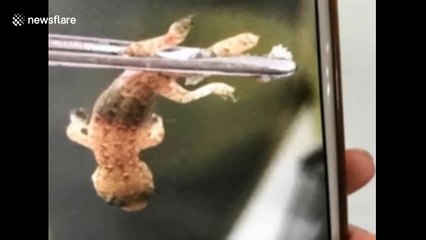 Doctor removes live gecko from man's ear