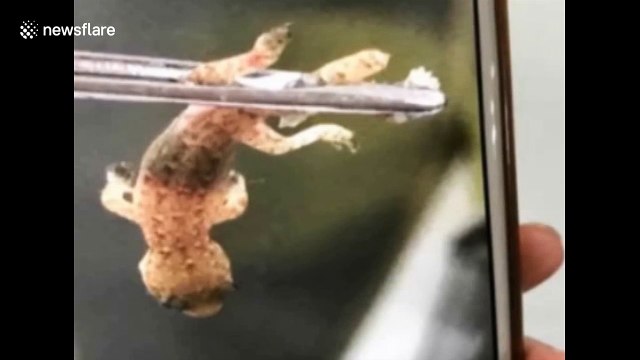 Doctor removes live gecko from man's ear