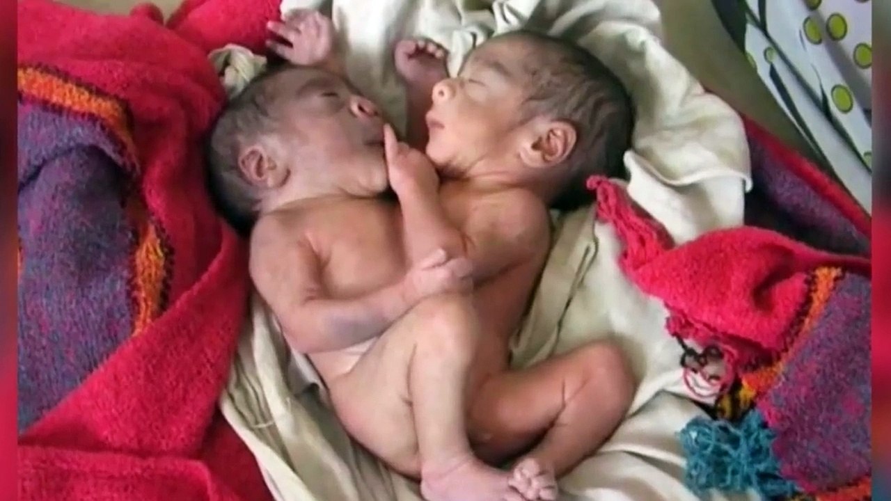 जब एलियन बच्ची ने लिया जन्म डॉक्टरो के भी पसीने छुट गए.....लडकिय इसे जरुर देखे ...Alien Baby born