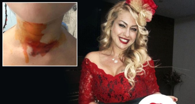 Yeliz Yeşilmen, Yemek Yemeğe Gittiği Mekanda Dehşeti Yaşadı