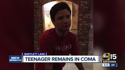 Teenager remains in coma after boating accident on Bartlett Lake