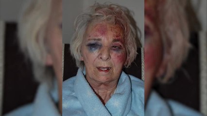 Police Hunt Woman Who Strangled Pensioner With A Dog Lead