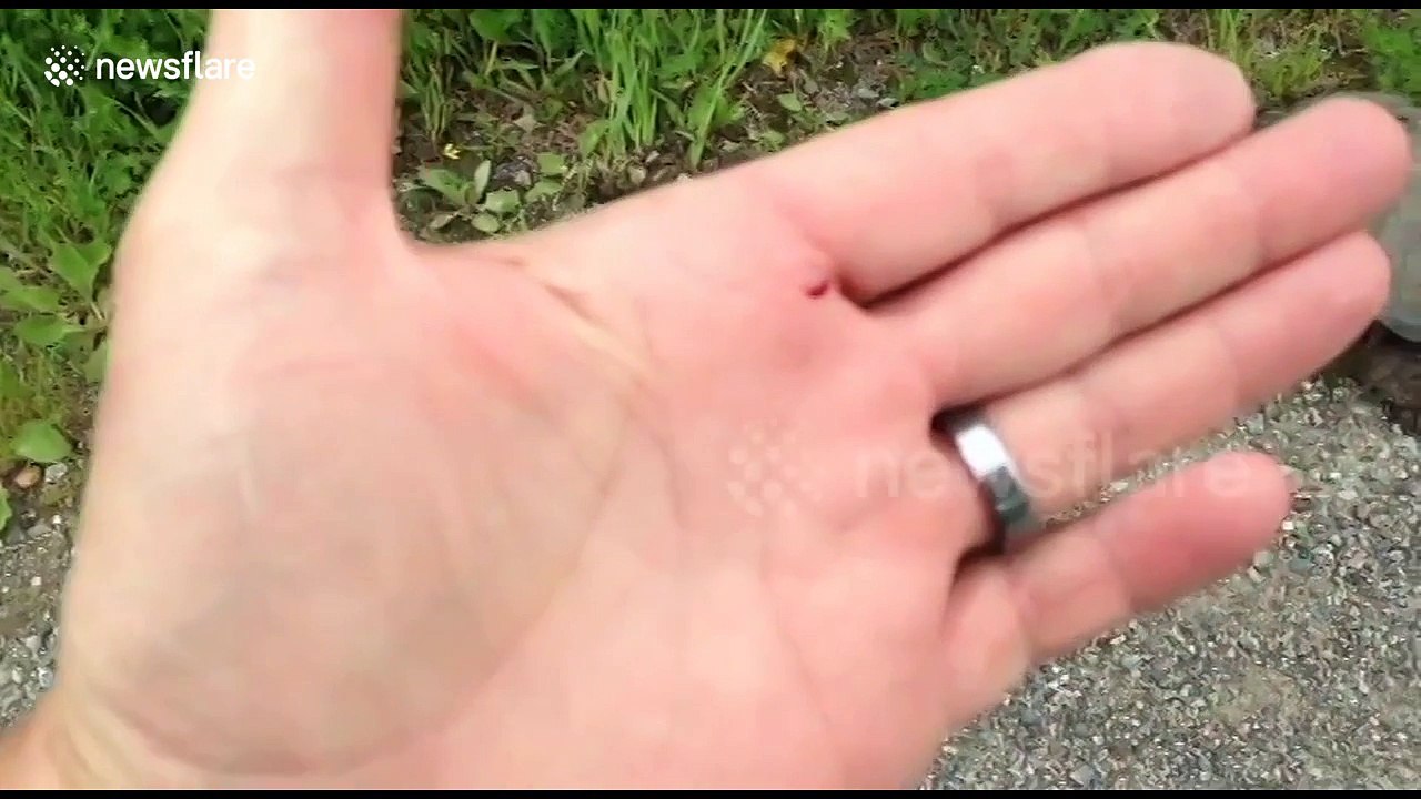 Snapping turtle bites man's hand