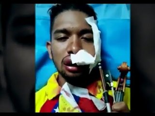 Le destruyen la cara, pero no su violín en protesta contra Maduro | Noticias con Ciro Gómez Leyva