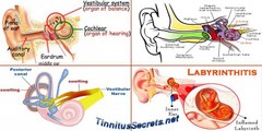 Inner Ear Problems and Tinnitus