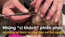 Những “vị khách” phiền phức và đáng sợ thích trú ngụ trên cơ thể người