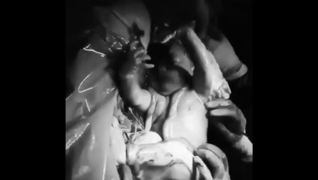 Khoảnh khắc xúc động bác sĩ xé toang túi ối chào đón em ra đời