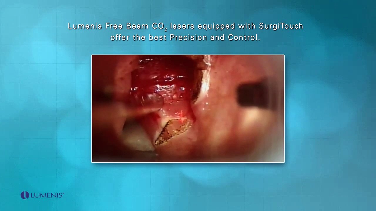 AcuPulse 40WG CO2 Lumenis Surgical