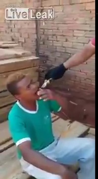Se faire arracher une dent à la pince sur un chantier... DOULEUR !!