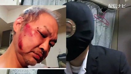 【横山緑】ウナちゃんマンが襲撃され顔がボコボコについて語る（ニコ生）