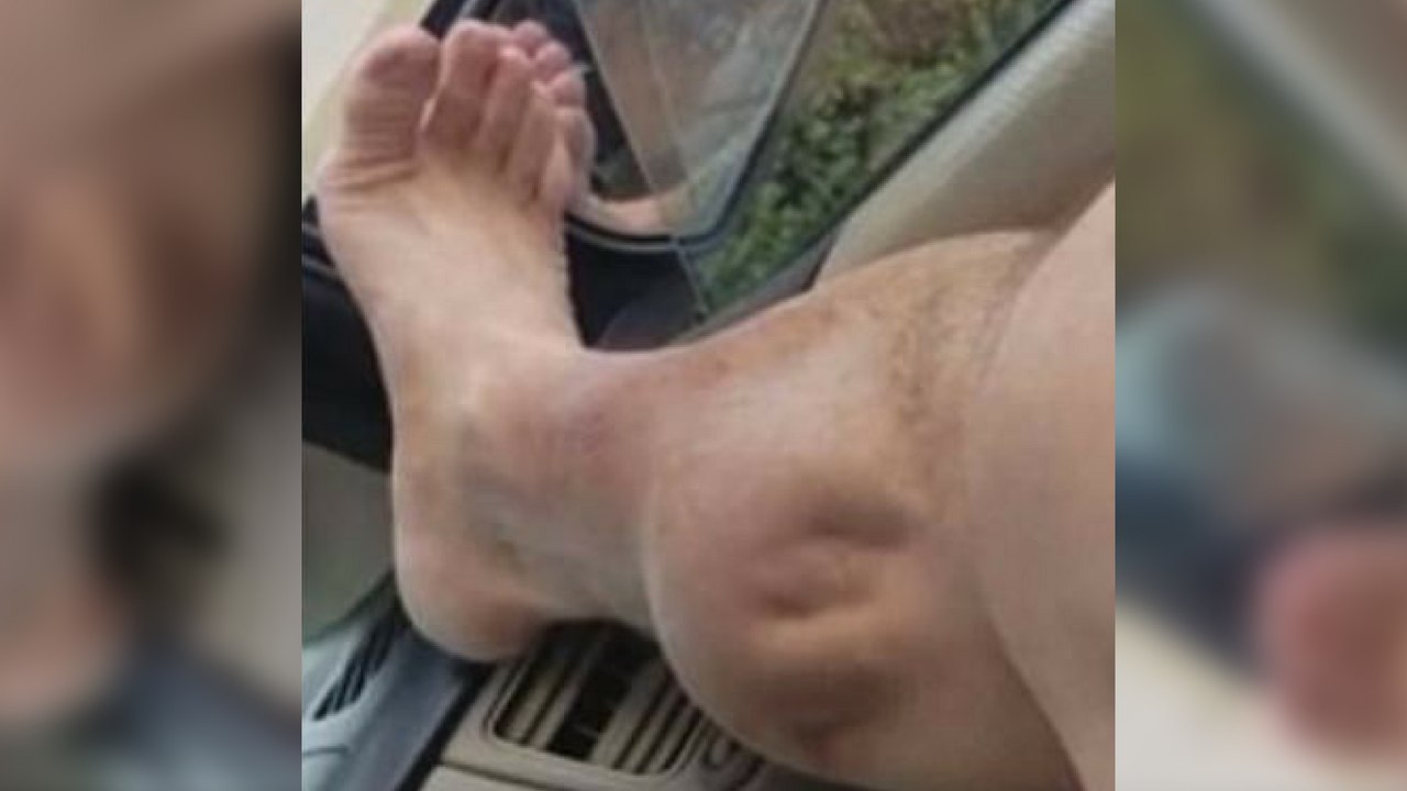 Après une séance de musculation..Il a filmé ses crampes au mollet !
