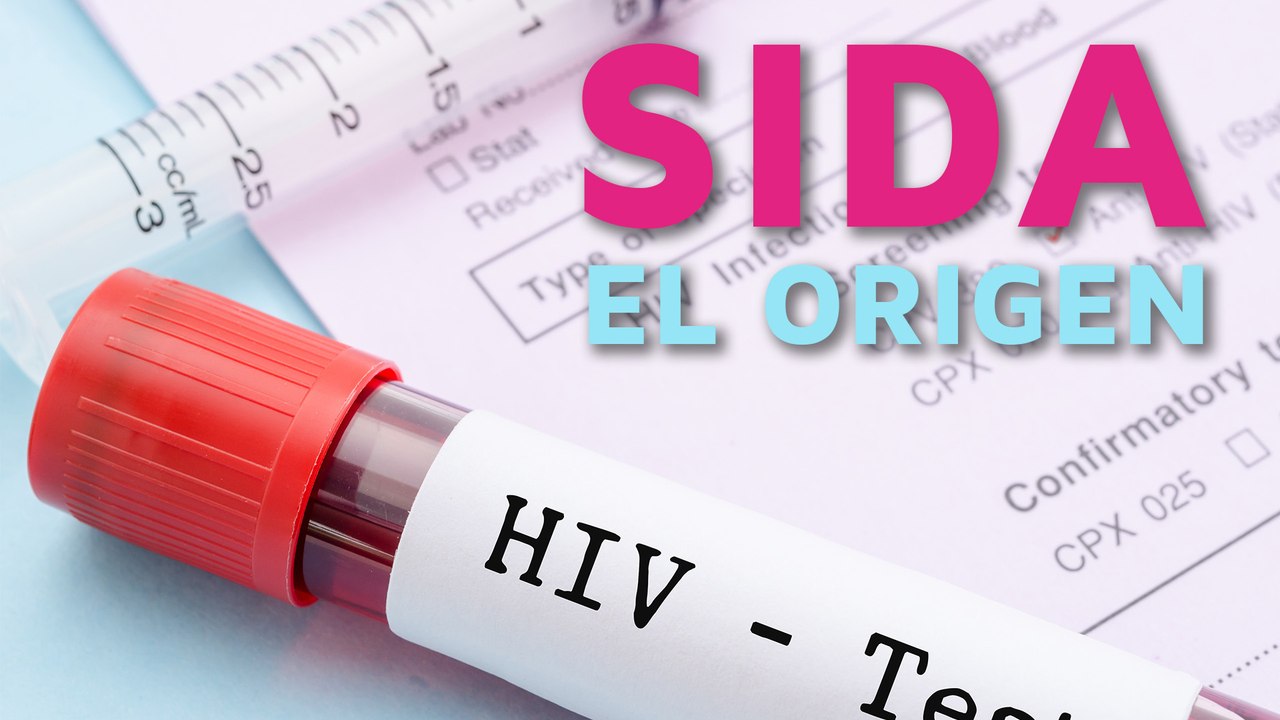 ¿Cuál es el origen del sida? ¿Desde cuándo existe?