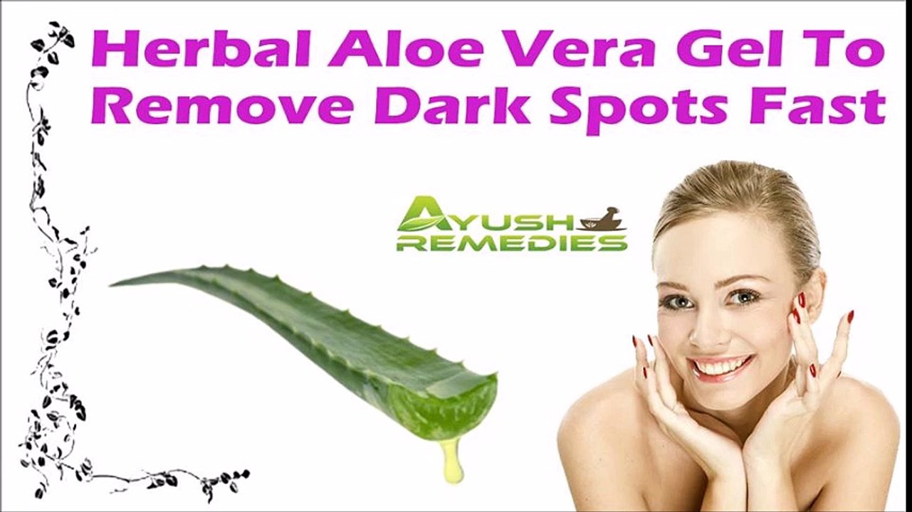 Herbal Aloe Vera Gel To Remove Dark Spots Fast