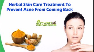 Herbal Skin Care Treatment To Prevent Acne From Coming Back