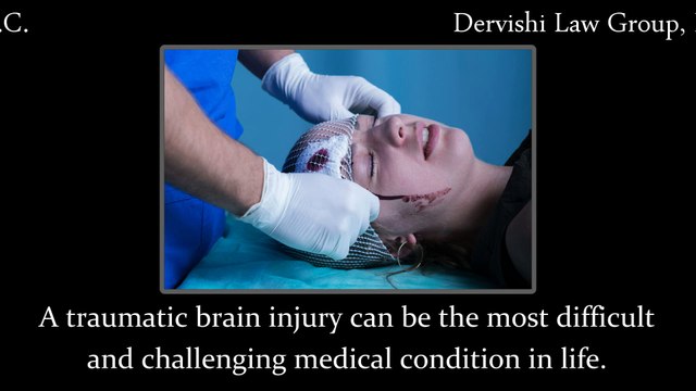 Traumatic Brain Injury Attorneys