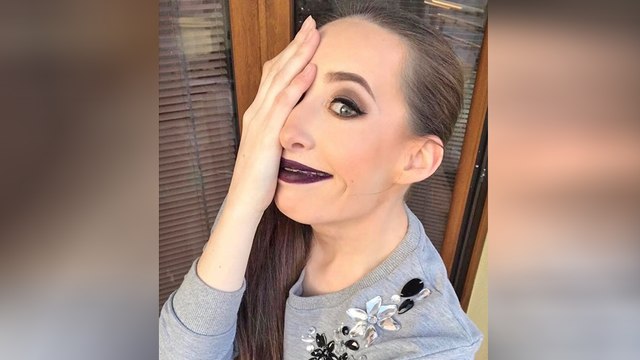 Bullied Woman Always Hides Half Her Face In Selfies, Then Reveals Rare Congenital Defect