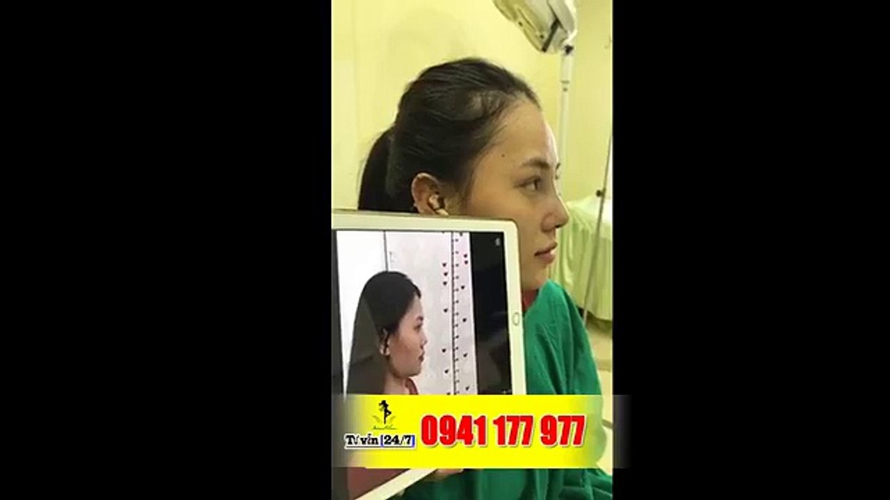 ĐẦU MŨI TO - PHẢI LÀM THẾ NÀO?