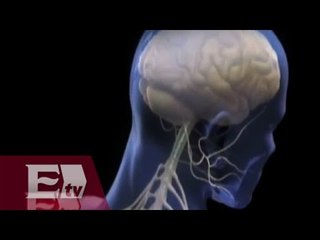 Sin su consentimiento, implantan dispositivo cerebral a pacientes con hidrocefalia/ Vianey Esquinca