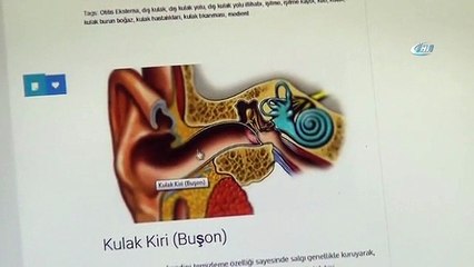 Doç. Dr. Yorgancılar: "Kulak Çöpü Sağır Bırakıp Felç Edebilir"